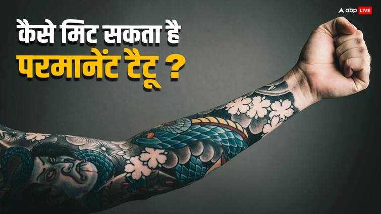 Can a permanent tattoo be completely removed What is the most effective way to remove it Permanent Tattoo: क्या पूरी तरह मिट सकता है परमानेंट टैटू, हमेशा के लिए हटाने के लिए करना होगा ये काम