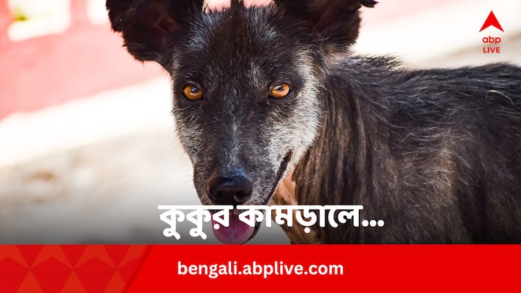 Dog Bite First Aid Prevent Infection Take Vaccine In Bengali