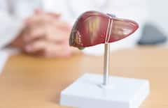 ફેટી લીવર અથવા લીવરમાં સોજાના લક્ષણો શું છે, તેને કઈ રીતે ઓળખશો, જાણો બચાવના ઉપાય