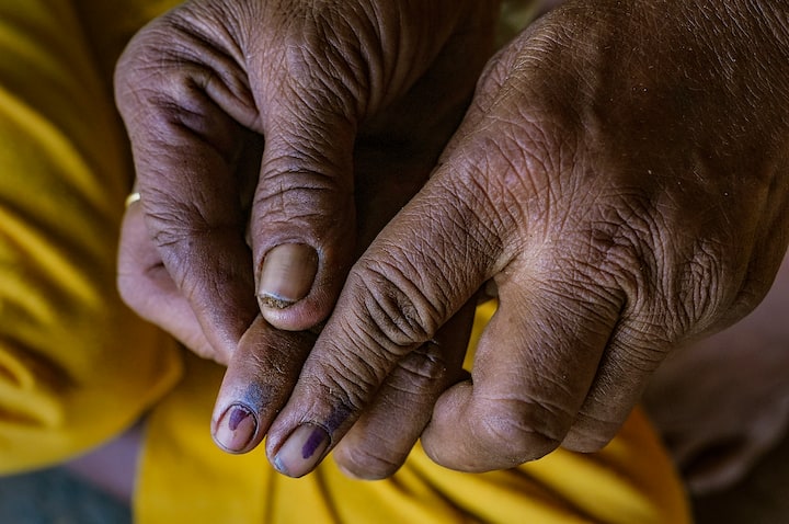 अब आपने कई लोगों के हाथ में ये स्याही तो जरूर लगी देखी होगी, लेकिन क्या आप जानते हैं कि कुछ लोगों के दोनों हाथों की उंगलियों में चुनावी स्याही लगाई जाती है.