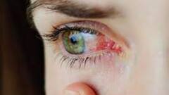 High Blood Pressure and Eye Disease: চোখে স্ট্রোক থেকে কর্নিয়ায় রক্ত জমাট বাঁধা, লাগামছাড়া ব্লাড প্রেসার কাড়তে পারে দৃষ্টিশক্তিও