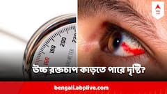 High Blood Pressure and Eye Disease: চোখে স্ট্রোক থেকে কর্নিয়ায় রক্ত জমাট বাঁধা, লাগামছাড়া ব্লাড প্রেসার কাড়তে পারে দৃষ্টিশক্তিও
