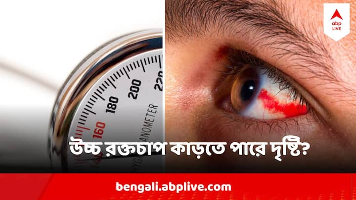 Hypertensive Retinopathy: হাইপারটেনশন বা হাই ব্লাড প্রেসার। হার্ট থেকে মস্তিষ্ক, যে কোনও কিছুকে ধাক্কা মারতে পারে সরাসরি।