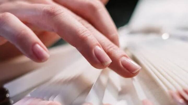 नाखूनों पर सफेद निशान या धब्बे होना आम बात है. एक्सपर्ट के मुताबिक इसके कई कारण हो सकते हैं. जैसे प्रोटीन, कैल्शियम, जिंक, विटामिन A, आयरन, मैग्नीशियम, सोडियम, और कॉपर जैसे पोषक तत्वों की कमी है.