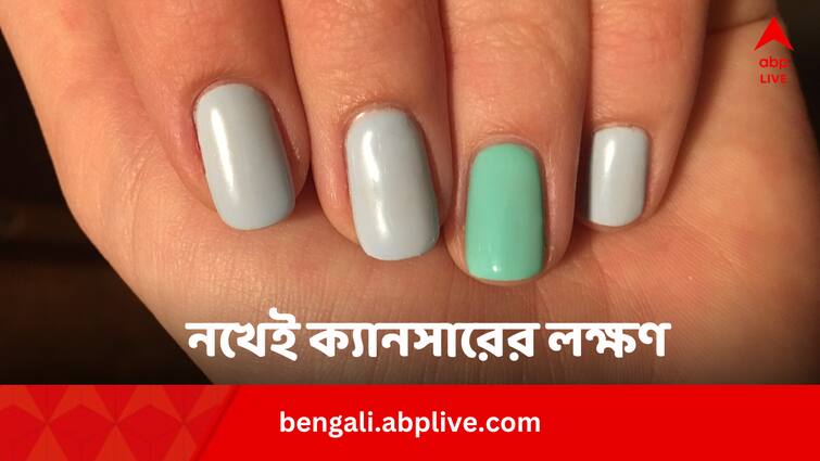 Cancer Signs Nail Colour Change And Thickening In Bengali Cancer Signs: নখের রং দেখেই ক্যানসার চেনা সম্ভব ! কীভাবে ?