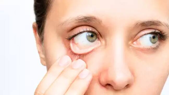 Health Risk on indian people read what is aplastic anemia know causes symptoms and treatment Health Risk: શરીરમાં કેન્સરનું કારણ બની શકે છે એપ્લાસ્ટિક એનિમિયા, જાણો બચવા માટે શું કરવું ?