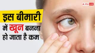 Health Risk: कैंसर का कारण बन सकता है अप्लास्टिक एनीमिया, जानें बचने के लिए क्या करें?