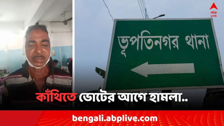 Lok Sabha Election 2024 Contai Lok Sabha Constituency  Bhupatinagar BJP leader attacked by TMC Goons Lok Sabha Election 2024:কাঁথিতে ভোটের আগে BJP নেতাদের উপর 'হামলা', আনা হল কলকাতার হাসপাতালে..