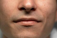 Lips Care Tips: काले होंठ बन गए हैं शर्मिंदगी का कारण तो इन चीजों का रोजाना करें इस्तेमाल