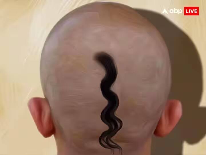 જ્યોતિષ શાસ્ત્ર અનુસાર જો કોઈ વ્યક્તિની કુંડળીમાં રાહુ ખરાબ અસર આપી રહ્યો હોય તો તેણે પોતાના માથા પર ચોટી રાખવી જોઈએ. રાહુની સ્થિતિમાં આ ફાયદાકારક છે.