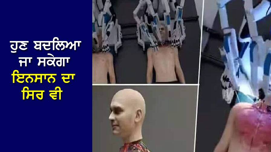 Head Transplant: Now a person's head can be transplanted on another person, know how the head transplant will be done through AI Head Transplant: ਹੁਣ ਇੱਕ ਇਨਸਾਨ ਦਾ ਸਿਰ ਦੂਜੇ ਇਨਸਾਨ ਉੱਤੇ ਲਗਾਇਆ ਜਾ ਸਕੇਗਾ, ਜਾਣੋ AI ਰਾਹੀਂ ਕਿਵੇਂ ਹੋਵੇਗਾ ਸਿਰ ਦਾ ਟ੍ਰਾਂਸਪਲਾਂਟ