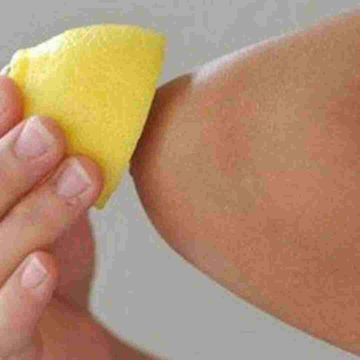 ਨਿੰਬੂ, ਜੋ ਕਿ ਇੱਕ ਕੁਦਰਤੀ ਬਲੀਚ ਦੀ ਤਰ੍ਹਾਂ ਕੰਮ ਕਰਦਾ ਹੈ, ਤੁਹਾਡੀਆਂ ਕੂਹਣੀਆਂ, ਗੋਡਿਆਂ, ਉਂਗਲਾਂ ਆਦਿ ਤੋਂ ਕਾਲੇਪਨ ਨੂੰ ਦੂਰ ਕਰਨ ਵਿੱਚ ਬਹੁਤ ਪ੍ਰਭਾਵਸ਼ਾਲੀ ਹੈ। ਇਹ ਡੈੱਡ ਸਕਿਨ ਅਤੇ ਗੰਦਗੀ ਨੂੰ ਦੂਰ ਕਰਕੇ ਸਕਿਨ ਟੋਨ ਨੂੰ ਸਾਫ ਕਰਨ 'ਚ ਮਦਦਗਾਰ ਹੈ। ਕਾਲੇਪਨ ਨੂੰ ਦੂਰ ਕਰਨ ਲਈ ਨਿੰਬੂ ਨੂੰ ਅੱਧਾ ਕੱਟ ਕੇ ਉਸ ਵਿਚ ਸ਼ਹਿਦ ਜਾਂ ਚੀਨੀ ਮਿਲਾ ਕੇ ਕੁਝ ਦੇਰ ਤਕ ਪ੍ਰਭਾਵਿਤ ਥਾਂਵਾਂ ਦੀ ਮਾਲਿਸ਼ ਕਰੋ। ਹਫ਼ਤੇ ਵਿੱਚ ਤਿੰਨ ਤੋਂ ਚਾਰ ਵਾਰ ਇਸ ਉਪਾਅ ਦੀ ਵਰਤੋਂ ਕਰਨ ਨਾਲ ਬਹੁਤ ਵਧੀਆ ਨਤੀਜਾ ਮਿਲਦਾ ਹੈ।