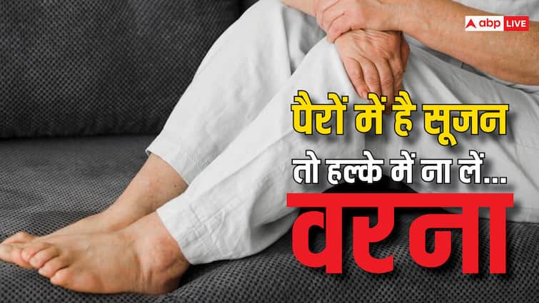 पैरों में है सूजन तो हो जाएं सावधान ! इन 5 बीमारियों का मंडरा सकता है खतरा