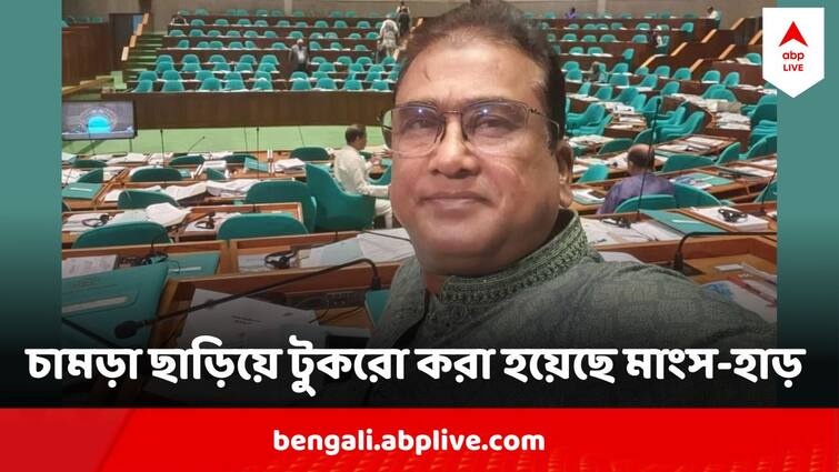 Bangladesh MP Anwarul Azim Anar murdered in Kolkata butcher cuts body Bangladesh MP Murder mystery deepens Bangladesh MP Murder: মুম্বই থেকে কষাই এনে টুকরো করা হয়েছে শরীর, কোথায় সেই মাংস? বাংলাদেশের MP খুনে চাঞ্চল্যকর তথ্য