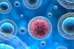 Cancer : ਕਿਉਂ ਨਹੀਂ ਦੱਸਦੇ ਡਾਕਟਰ ਮਰੀਜ਼ਾਂ ਨੂੰ ਕੈਂਸਰ ਬਾਰੇ ?