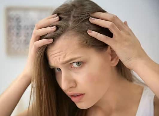 What are the causes of gray hair at a young age Know solution નાની ઉંમરે વાળ સફેદ થવાના કારણો શું ?  જાણો શું છે તેનો ઉપાય