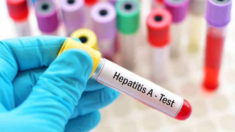 Kerala records spike in Hepatitis A cases 4 districts on highalert Kerala Hepatitis A: కేరళలో మరోవిపత్తు, రాష్ట్ర వ్యాప్తంగా హెపటైటిస్ A విజృంభణ, 12 మందికి పైగా మృతి