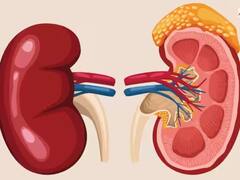 Kidney Dialysis Tips: ਡਾਇਲਸਿਸ ਤੋਂ ਬਾਅਦ ਜੇ ਇਨ੍ਹਾਂ ਗੱਲਾਂ ਉੱਤੇ ਨਾ ਦਿੱਤਾ ਧਿਆਨ ਤਾਂ ਹੋ ਸਕਦਾ ਸਰੀਰ ਨੂੰ ਵਧੇਰੇ ਨੁਕਸਾਨ, ਜਾਣੋ ਡਿਟੇਲ