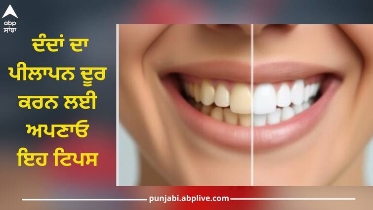 Follow these tips to remove yellowness of the teeth, mix it with curd and rub it for 2 minutes, you will get benefit White Teeth: ਦੰਦਾਂ ਦਾ ਪੀਲਾਪਨ ਦੂਰ ਕਰਨ ਲਈ ਅਪਣਾਓ ਇਹ ਟਿਪਸ, ਦਹੀਂ 'ਚ ਮਿਲਾ ਕੇ ਬਸ 2 ਮਿੰਟ ਤੱਕ ਰਗੜੋ, ਮਿਲੇਗਾ ਫਾਇਦਾ