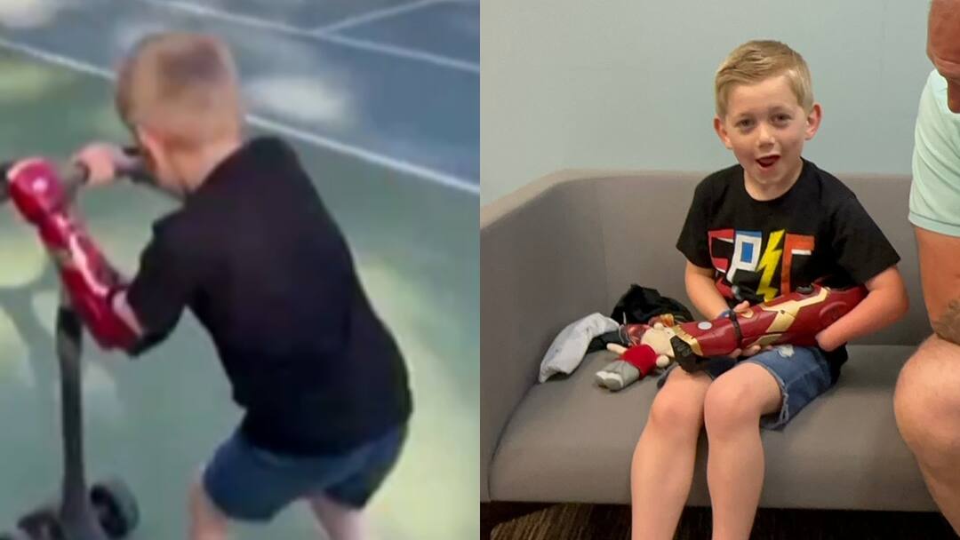 Watch Video: அமெரிக்க சிறுவனுக்கு கிடைத்துள்ள புது வாழ்வு.. பயோனிக் கையால் கிடைத்த இடது நம்பிக்(கை)..!