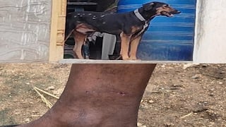 வெளிநாட்டில் கிடைத்த வேலை... நாய் கடித்ததால் கடைசி நேரத்தில் பயணம் ரத்து - மதுரைக்காரர் வேதனை