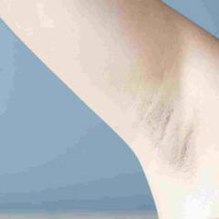 Darkness of Armpits : ਕੀ ਤੁਹਾਨੂੰ ਵੀ ਕੱਛ ਦਾ ਕਾਲਾਪਨ ਕਰਦਾ ਹੈ ਸ਼ਰਮਸ਼ਾਰ ਤਾਂ ਅਪਣਾਓ ਆਹ  ਘਰੇਲੂ ਉਪਾਅ