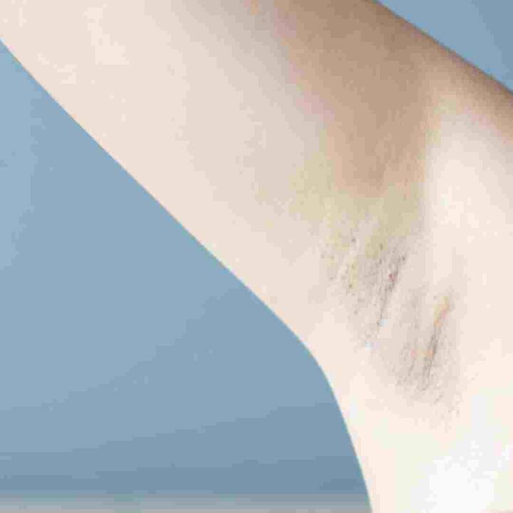 ਕਾਲੀ ਕੱਛ ਦੀ ਚਮੜੀ ਤੋਂ ਛੁਟਕਾਰਾ ਪਾਉਣ ਲਈ, ਤੁਹਾਨੂੰ ਮਹਿੰਗੇ ਉਤਪਾਦ ਜਾਂ ਇਲਾਜ ਖਰੀਦਣ ਦੀ ਜ਼ਰੂਰਤ ਨਹੀਂ ਹੈ, ਕਿਉਂਕਿ ਤੁਹਾਡੀ ਰਸੋਈ ਵਿੱਚ ਬਹੁਤ ਸਾਰੀਆਂ ਚੀਜ਼ਾਂ ਹਨ ਜਿਨ੍ਹਾਂ ਦੀ ਵਰਤੋਂ ਕਰਕੇ ਤੁਸੀਂ ਕਾਲੀ ਕੱਛ ਦੀ ਚਮੜੀ ਤੋਂ ਛੁਟਕਾਰਾ ਪਾ ਸਕਦੇ ਹੋ। ਤਾਂ ਆਓ ਜਾਣਦੇ ਹਾਂ।