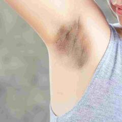 Darkness of Armpits : ਕੀ ਤੁਹਾਨੂੰ ਵੀ ਕੱਛ ਦਾ ਕਾਲਾਪਨ ਕਰਦਾ ਹੈ ਸ਼ਰਮਸ਼ਾਰ ਤਾਂ ਅਪਣਾਓ ਆਹ  ਘਰੇਲੂ ਉਪਾਅ