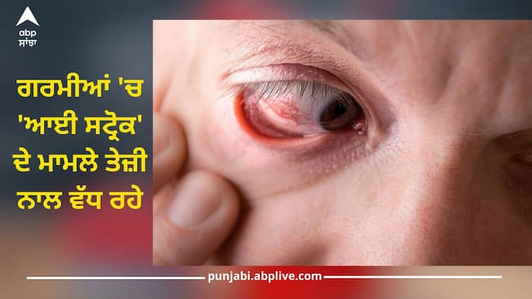 The cases of 'eye stroke' are increasing rapidly in summer, take these measures for prevention Eye Stroke: ਗਰਮੀਆਂ 'ਚ 'ਆਈ ਸਟ੍ਰੋਕ' ਦੇ ਮਾਮਲੇ ਤੇਜ਼ੀ ਨਾਲ ਵੱਧ ਰਹੇ, ਰੋਕਥਾਮ ਲਈ ਕਰੋ ਇਹ ਉਪਾਅ