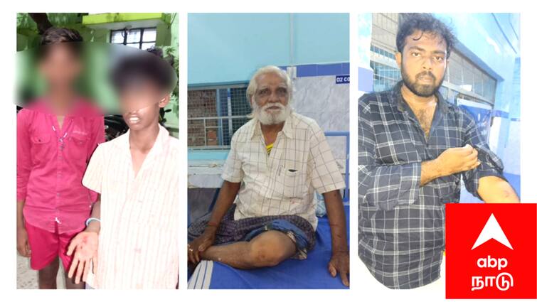 Mayiladuthurai news  stray dog biting four people near Sirkazhi - TNN அடுத்து அடுத்து 4 பேரை கடித்து குதறிய தெருநாய் - அச்சத்தில் சீர்காழி மக்கள்