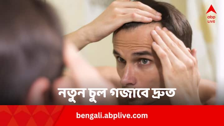 Daily Foods For Hair Growth: নতুন চুল গজাতে শুরু করলে চুল আর পাতলা হয় না। টাকও পড়ে না। কিছু খাবার এই সমস্যার সুরাহা।