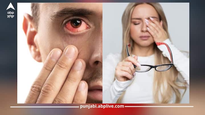 Eye Stroke: ਅਜਿਹੀ ਗਰਮੀ ਕਰਕੇ ਕਈ ਬਿਮਾਰੀਆਂ ਵੱਧ ਜਾਂਦੀਆਂ ਹਨ। ਗਰਮੀ ਦਾ ਕਹਿਰ ਦਿਨੋਂ ਦਿਨ ਵਧਦਾ ਜਾ ਰਿਹਾ ਹੈ। 75 ਫੀਸਦੀ ਲੋਕ ਡੀਹਾਈਡ੍ਰੇਸ਼ਨ ਦੀ ਲਪੇਟ ਵਿਚ ਹਨ। ਅਜਿਹੇ 'ਚ ਕਈ ਸਮੱਸਿਆਵਾਂ ਦਾ ਖਤਰਾ ਵੀ ਵਧ ਗਿਆ ਹੈ।