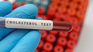 Cholesterol: વધેલું કોલેસ્ટ્રોલ જલ્દી કંટ્રોલમાં આવશે, આજથી જ આ 5 કામ કરવાનું શરૂ કરી દો