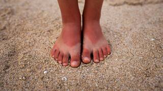 Feet Tanning: सैंडल पहनने से आपके पैरों में भी पड़ जाते हैं निशान, तो इन ट्रिक्स को करें फॉलो
