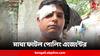Post Poll Violence:বেলেঘাটার পর ট্যাংরা, রক্তপাত জারি! মাথা ফাটল তাপস রায়ের পোলিং এজেন্টের