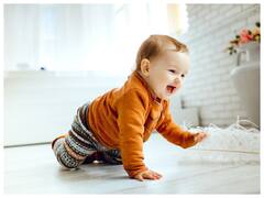 नवजात शिशु को क्यों होते हैं सैल्मन पैच (बर्थमार्क), जानें इसके लक्षण और कारण?