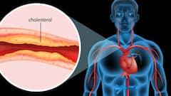 ज्यादा पानी पीने से बैड कोलेस्ट्रॉल कंट्रोल में रहता है? जानें क्या कहते हैं हेल्थ एक्सपर्ट