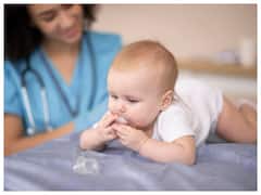 नवजात शिशु को क्यों होते हैं सैल्मन पैच (बर्थमार्क), जानें इसके लक्षण और कारण?