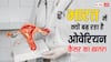 भारतीए महिलाओं में क्यों बढ़ रहा है ओवेरियन कैंसर का खतरा? जानें इसके पीछे की सबसे बड़ी वजह