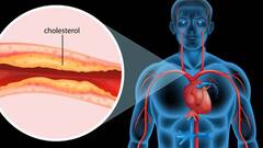 શું વધુ પાણી પીવાથી ખરાબ કોલેસ્ટ્રોલ નિયંત્રણમાં રહે છે? જાણો શું કહે છે આરોગ્ય નિષ્ણાતો