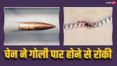 गले में पहनी चेन ने बचाई शख्स की जान, नहीं तो आर-पार हो जाती गोली