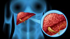 शरीर के किन-किन हिस्सों में बन सकती है पथरी, एक्सपर्ट ने बताया इसका कारण