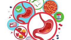 शरीर के किन-किन हिस्सों में बन सकती है पथरी, एक्सपर्ट ने बताया इसका कारण