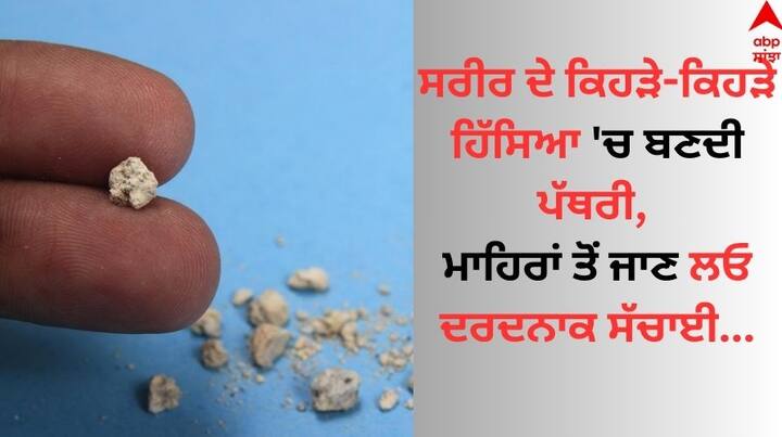 Which Body Parts Have Stones: ਅੱਜਕੱਲ੍ਹ ਦੇ ਲੋਕਾਂ ਵਿੱਚ ਪੱਥਰੀ ਨੂੰ ਸ਼ਿਕਾਇਤ ਆਮ ਸੁਣੀ ਜਾਂਦੀ ਹੈ।  ਪਰ ਕੀ ਤੁਸੀਂ ਜਾਣਦੇ ਹੋ ਕਿ ਕਿਡਨੀ ਤੋਂ ਅੱਜ ਅਸੀ ਤੁਹਾਨੂੰ ਦੱਸਾਂਗੇ ਸਰੀਰ ਦੇ ਕਿਹੜੇ ਹਿੱਸਿਆਂ 'ਚ ਪੱਥਰੀ ਹੋ ਸਕਦੀ ਹੈ।
