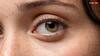 Dark Circles: इन चीजों का इस्तेमाल कर आप भी डार्क सर्कल्स से पा सकते हैं छुटकारा, कुछ ही दिनों में दिखने लगेगा असर