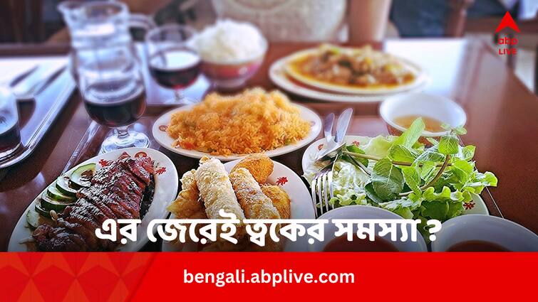 Excessive Salt From Fast Food Affecting Skin Know Remedies Fast Food Effects: ফাস্টফুডের জেরেই ত্বকের বেহাল দশা ? কোন উপকরণটি ক্ষতি করছে ?