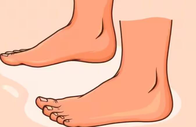 ਗਰਮੀਆਂ ਦੇ ਮੌਸਮ 'ਚ ਪੈਰਾਂ ਦੀਆਂ ਤਲੀਆਂ 'ਚ ਸਾੜ ਪੈਣ ਦੀ ਸਮੱਸਿਆ ਅਕਸਰ ਹੋਣੀ ਸ਼ੁਰੂ ਹੋ ਜਾਂਦੀ ਹੈ। ਇਸ ਦੇ ਪਿੱਛੇ ਦੇ ਕਈ ਕਾਰਨ ਹੋ ਸਕਦੇ ਹਨ, ਜਿਵੇਂ ਕਿ ਡੀਹਾਈਡ੍ਰੇਸ਼ਨ, ਬਹੁਤ ਜ਼ਿਆਦਾ ਥਕਾਵਟ ਅਤੇ ਲੱਤਾਂ 'ਚ ਖੂਨ ਦਾ ਸੰਚਾਰ ਵਧਣਾ।