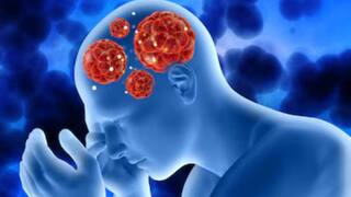World Brain Tumour Day 2024: किन लोगों को होता है ब्रेन ट्यूमर का सबसे ज्यादा खतरा? जानें इसके शुरुआती लक्षण