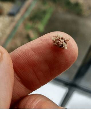 ਸਰੀਰ ਦੇ ਕਿਹੜੇ ਹਿੱਸਿਆ 'ਚ ਬਣਦੀ ਵੱਧ ਪੱਥਰੀ, ਸਾਵਧਾਨ ਹੋ ਜਾਓ ਮਰੀਜ਼