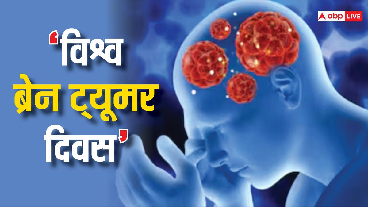 World Brain Tumour Day: न्यूरो सर्जरी के मामले में विकसित हो रहा कोटा, हर महीने 10 ब्रेन ट्यूमर का हो रहा ऑपरेशन